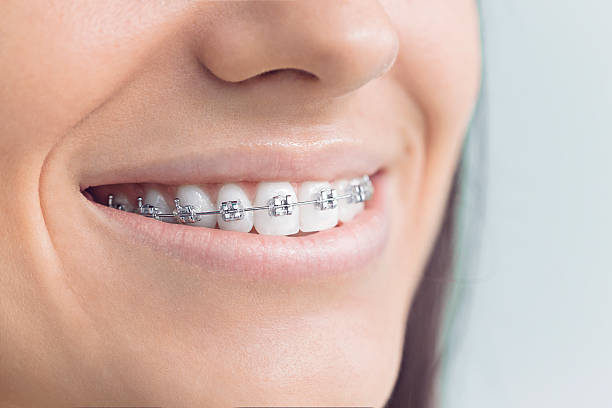 Full Mouth Reconstruction in Mancelona, MI